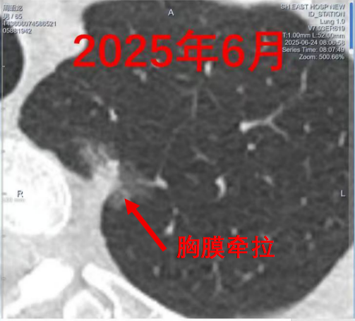 https://mmbiz.qpic.cn/sz_mmbiz_png/35Q7JmPav9CYrg8MV9jmhdHicgnKp6icbdZLxZGHRujzAKaJqb8ATOsqTqZic88URh2nxvMDP8Qh3TSicSiclNyia4Mg/640?wx_fmt=png&from=appmsg