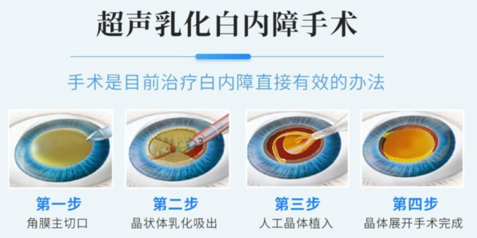 https://mmbiz.qpic.cn/sz_mmbiz_png/35Q7JmPav9DGJVicnbbZAhnNyI5gARvWf92bNsE8h4uxLM3x0d4EBK0FblcO8jP1cOuuuXdicuEmw7acO6iaLjsug/640?wx_fmt=png&from=appmsg